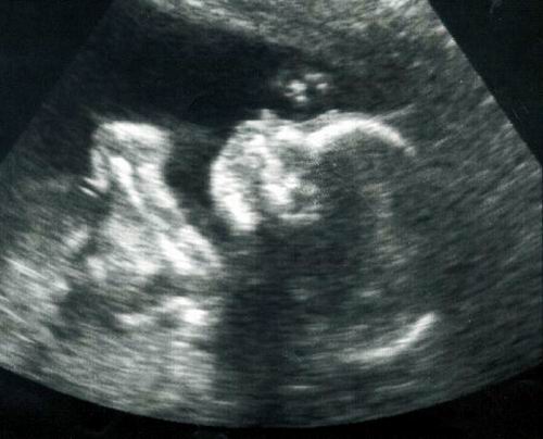 REFLEXIONES SOBRE LA MATERNIDAD SUBROGADA